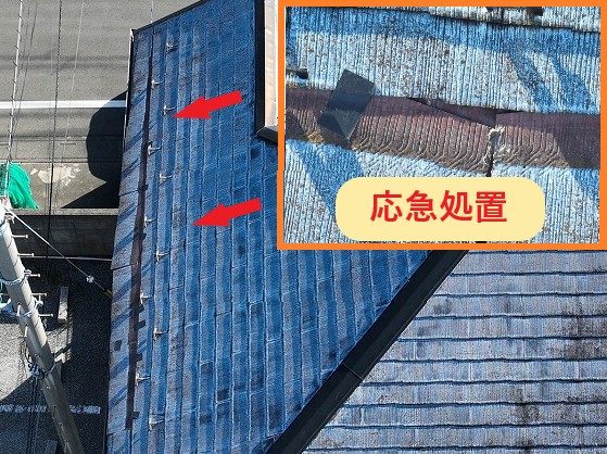 応急処置